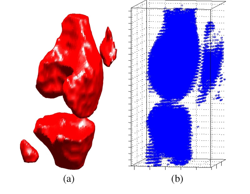 Segmentation of bones